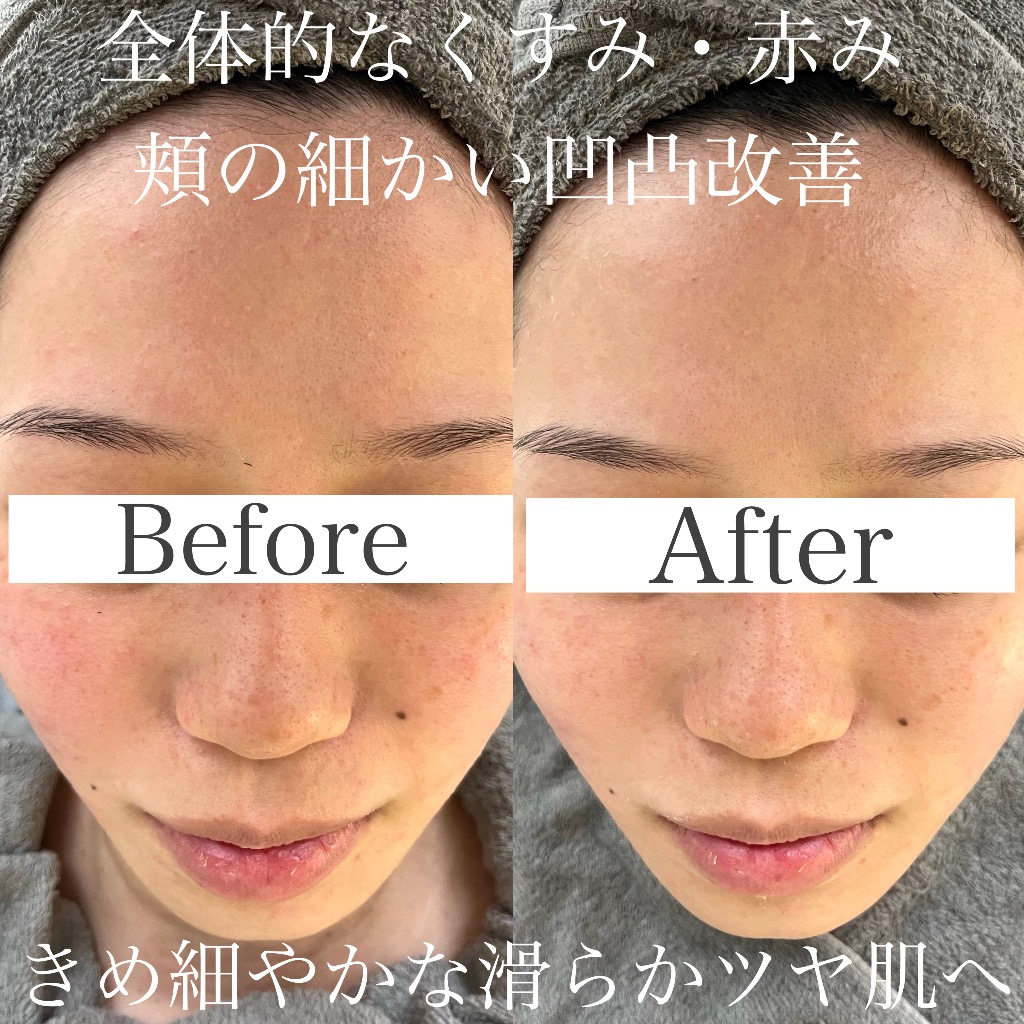 【Before&After】更新しました！