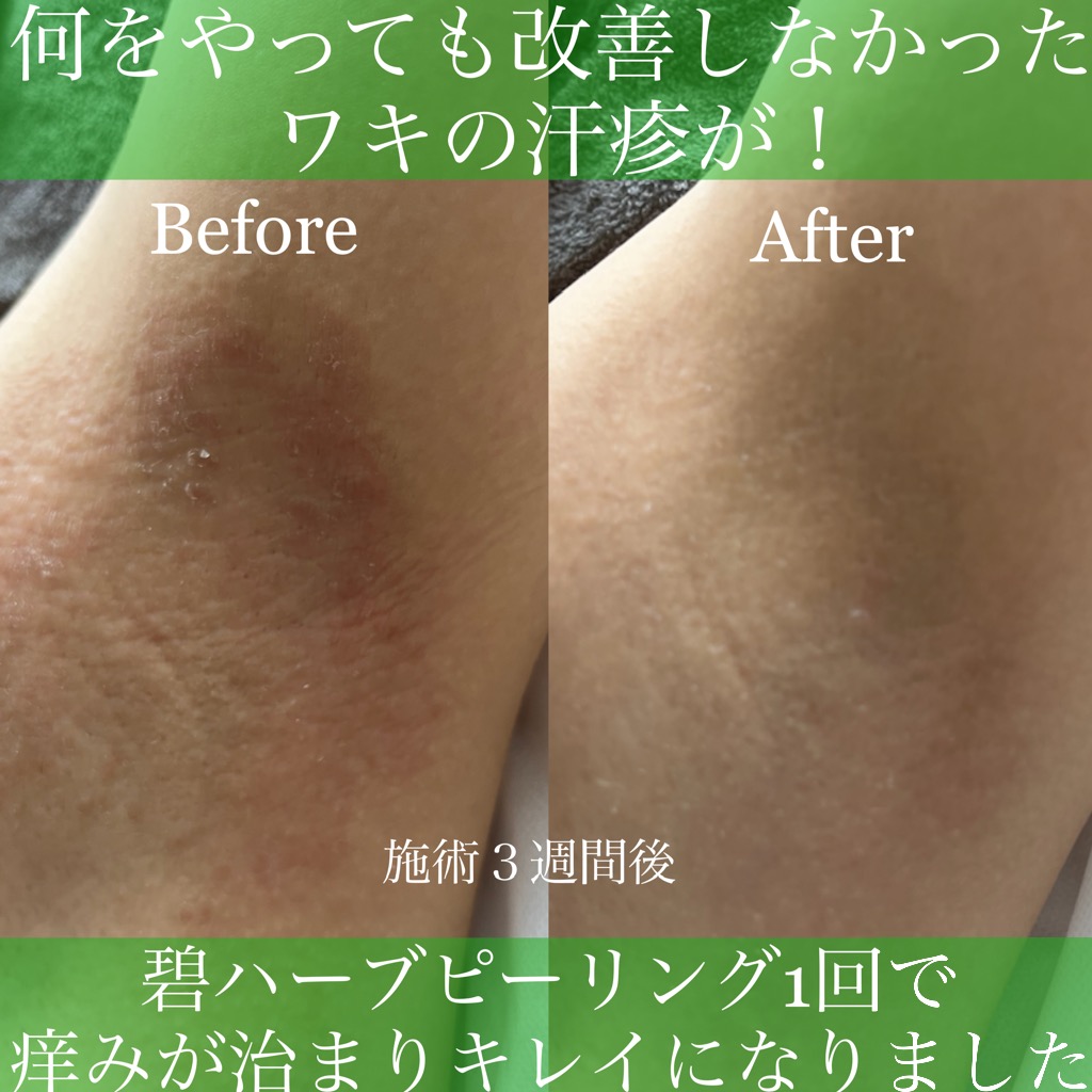 《Before＆After》更新しました！